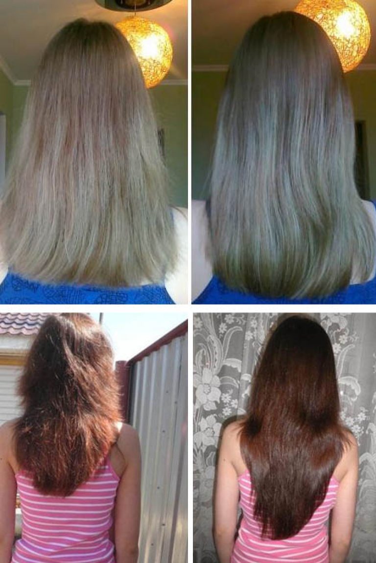 Как восстановить волосы отзывы. Волосы до после. Волосы после использования для роста. Рост волос до и после. Касторовое масло для волос до и после.