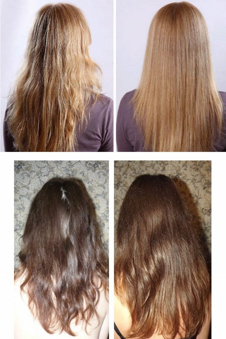 Волосы до и после масок для роста волос