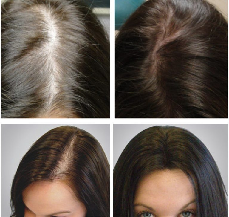 Топик для волос до и после