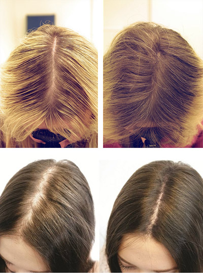 Маска для волос с перцем для роста волос фото до и после thumbnail