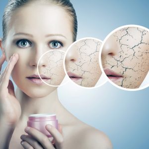 Как ухаживать за сухой кожей: очищение, тонизация, маска, крем